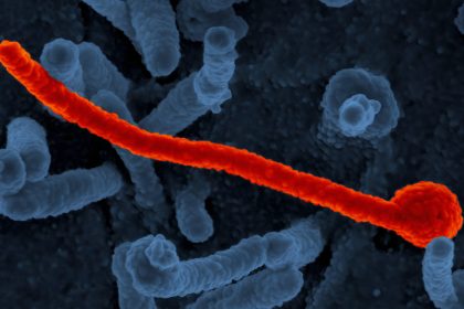 What Would You Do If an Ebola Patient Checked Into Your Hospital?