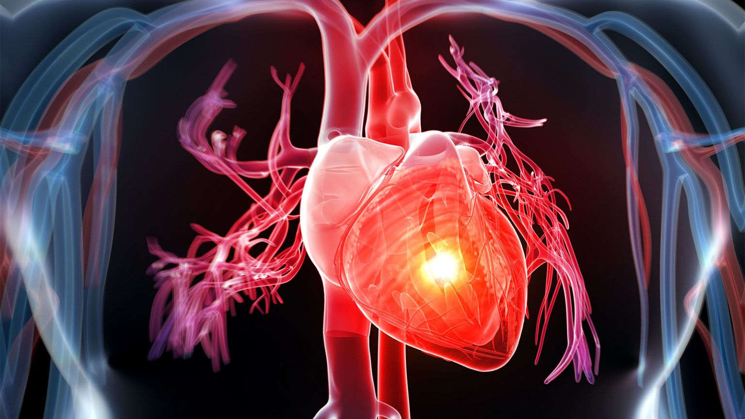 Safer Antiplatelet Routines, Non-Statin Meds Feature in New Heart Attack Guidelines