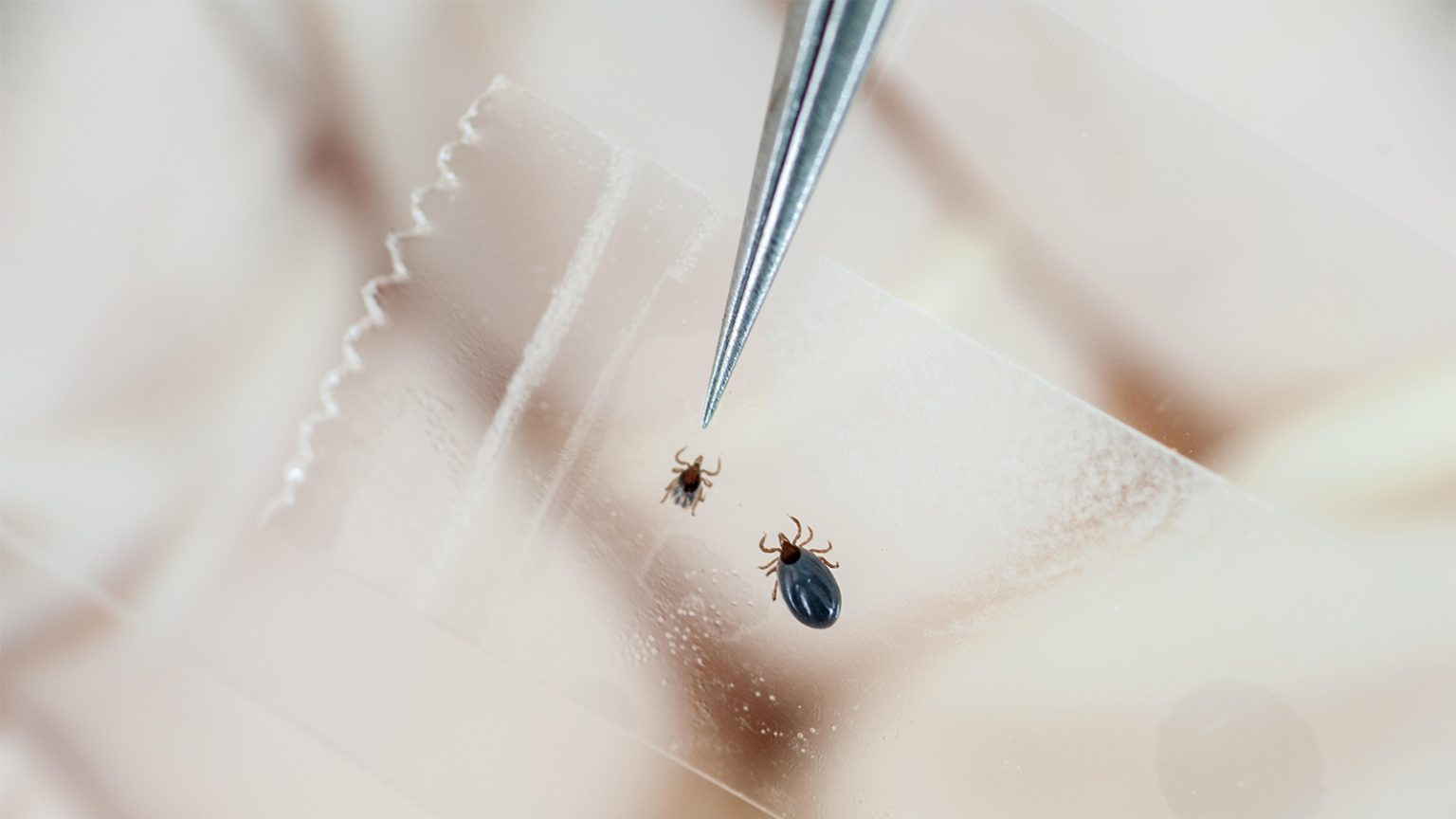 Lyme Disease Researcher Fired by CDC