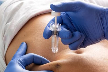 Subcutaneous Guselkumab Proves Efficacious for IBD