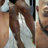 EXCLUSIVE: DSS Detains NANS President Atiku Isah In Hospital After Exposing Seyi Tinubu’s N100Million Bribe Offer, Forced To Recant, Made To Pose With Gun For Blackmail