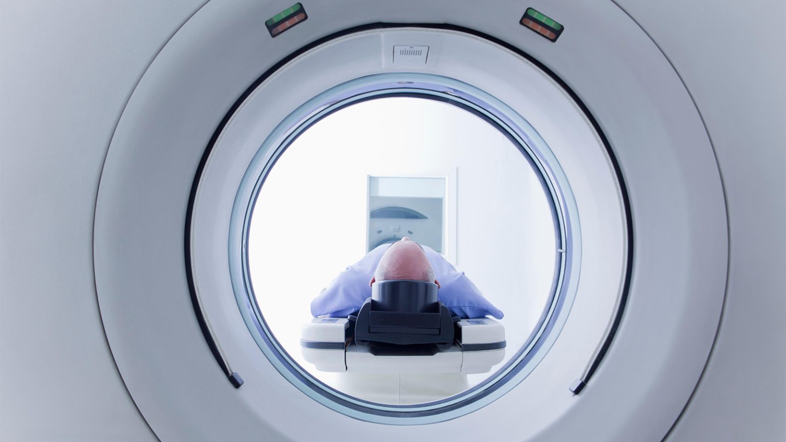 Comorbidities in Midlife Tied to Cancer Risk