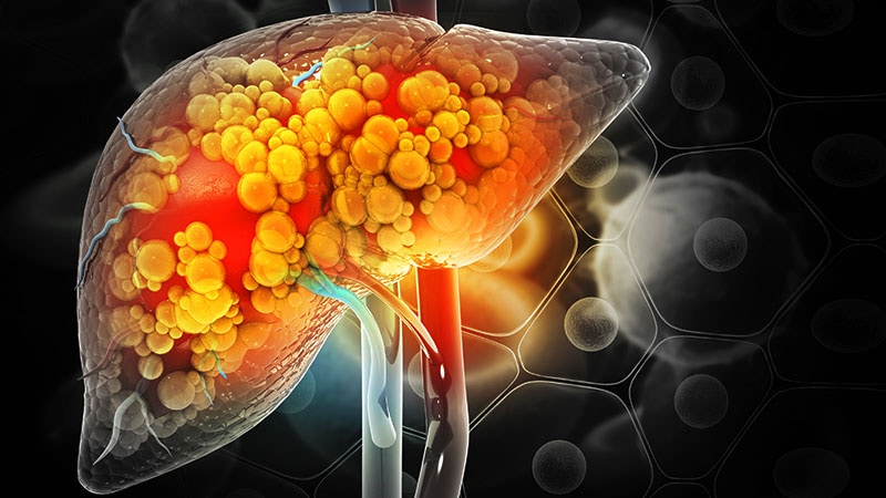 Statin-Antibiotic Combo Fails in Decompensated Cirrhosis