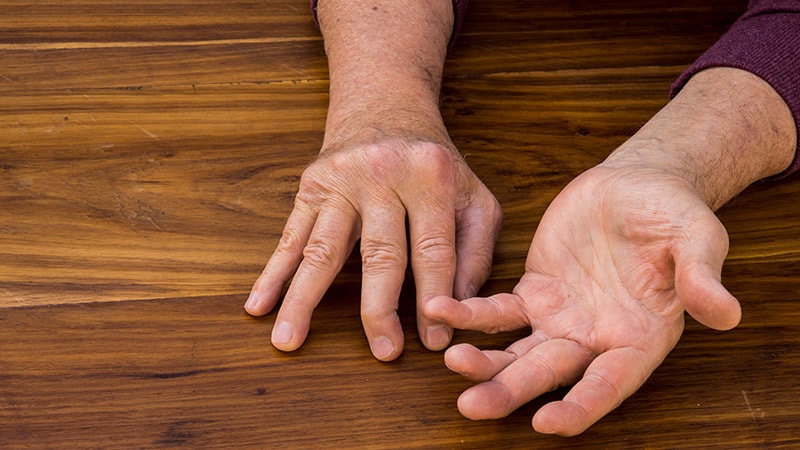 Lags in Psoriatic Arthritis vs Rheumatoid Arthritis Care