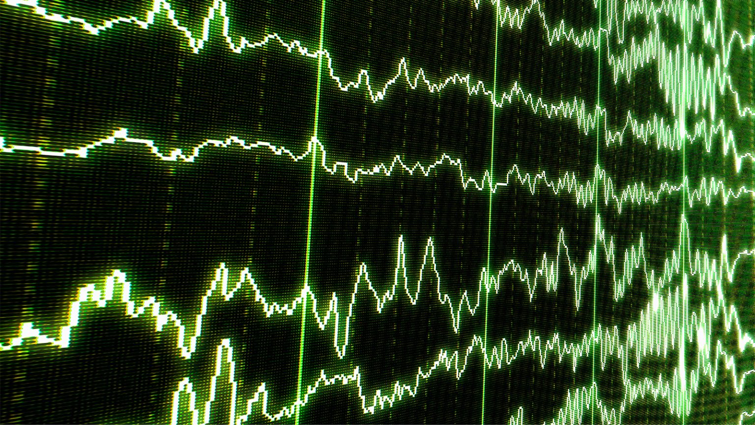 Hidden Consciousness in Comatose Patients Identified by Sleep Spindles