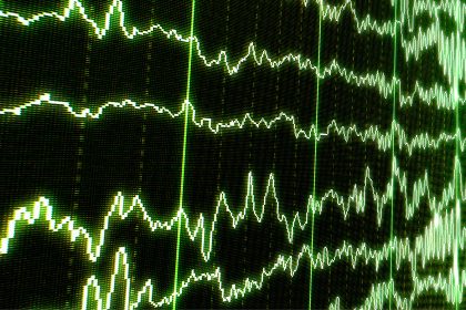 Hidden Consciousness in Comatose Patients Identified by Sleep Spindles