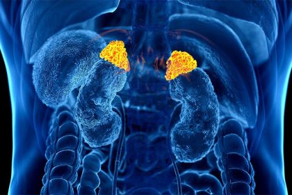 Popular Urine Test Predicts Death Risk in Adrenal Adenomas
