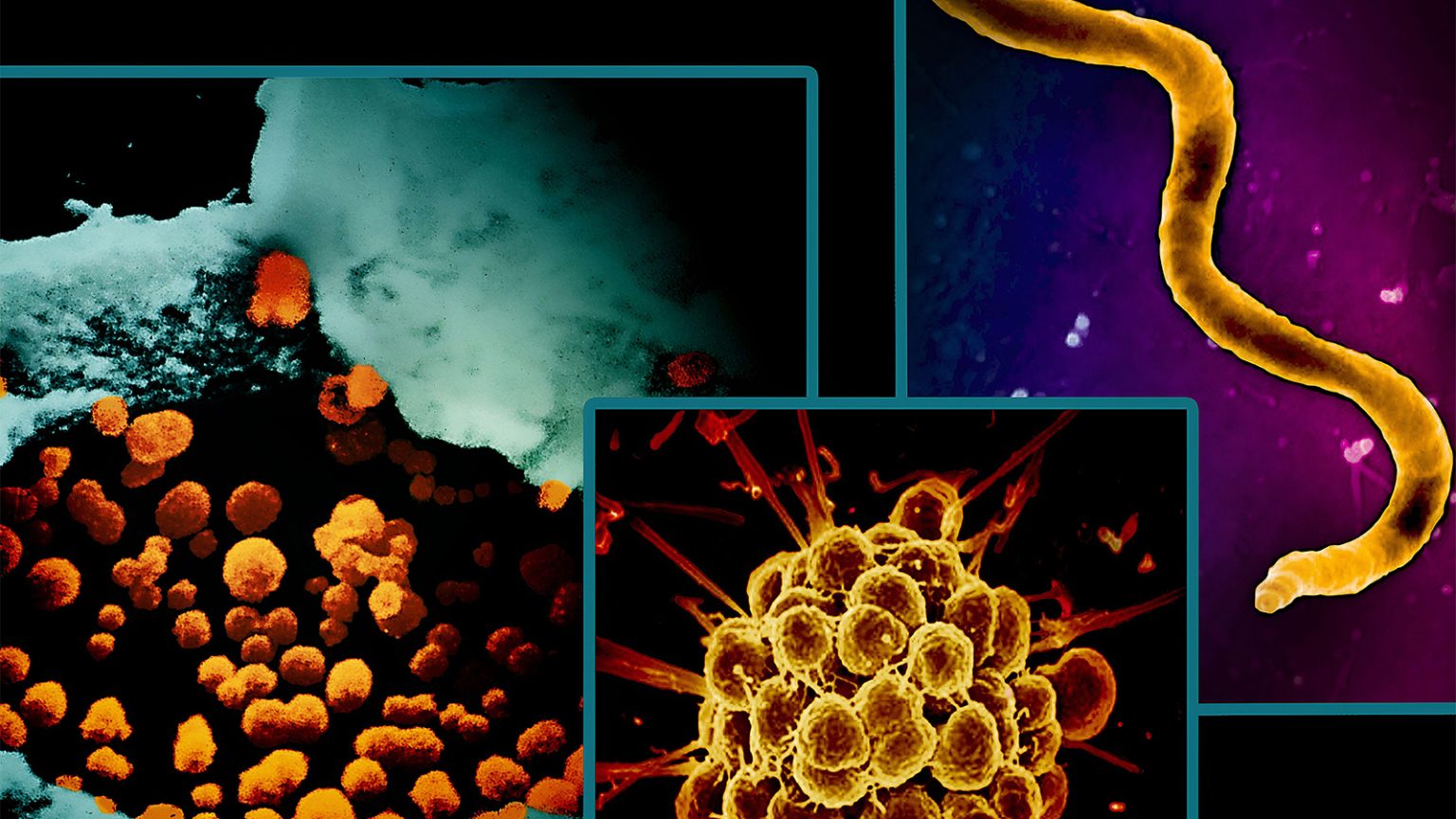 CDC’s STD Lab Shuttered By Trump Layoffs