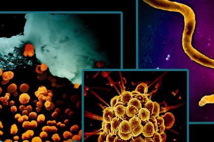 CDC’s STD Lab Shuttered By Trump Layoffs