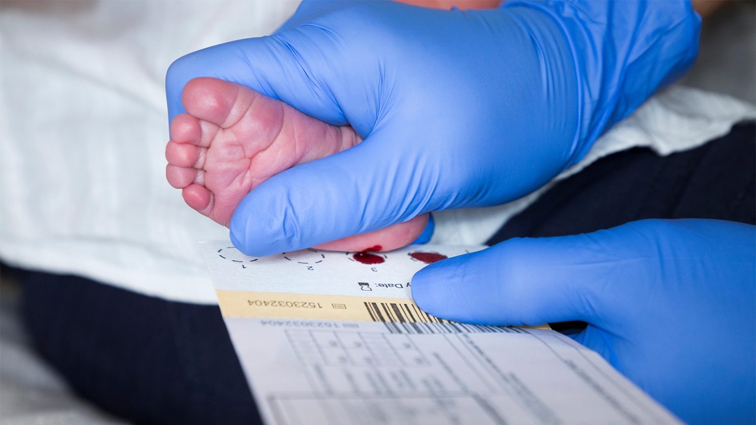 HHS Scraps Advisory Committee on Newborn Screening