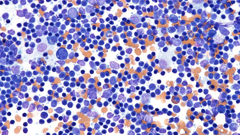 Study Charts Success in Elderly Lymphoma Tx