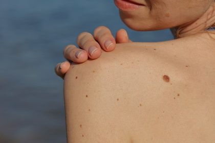 Autonomous Imaging Device Matches Manual Dermoscopy