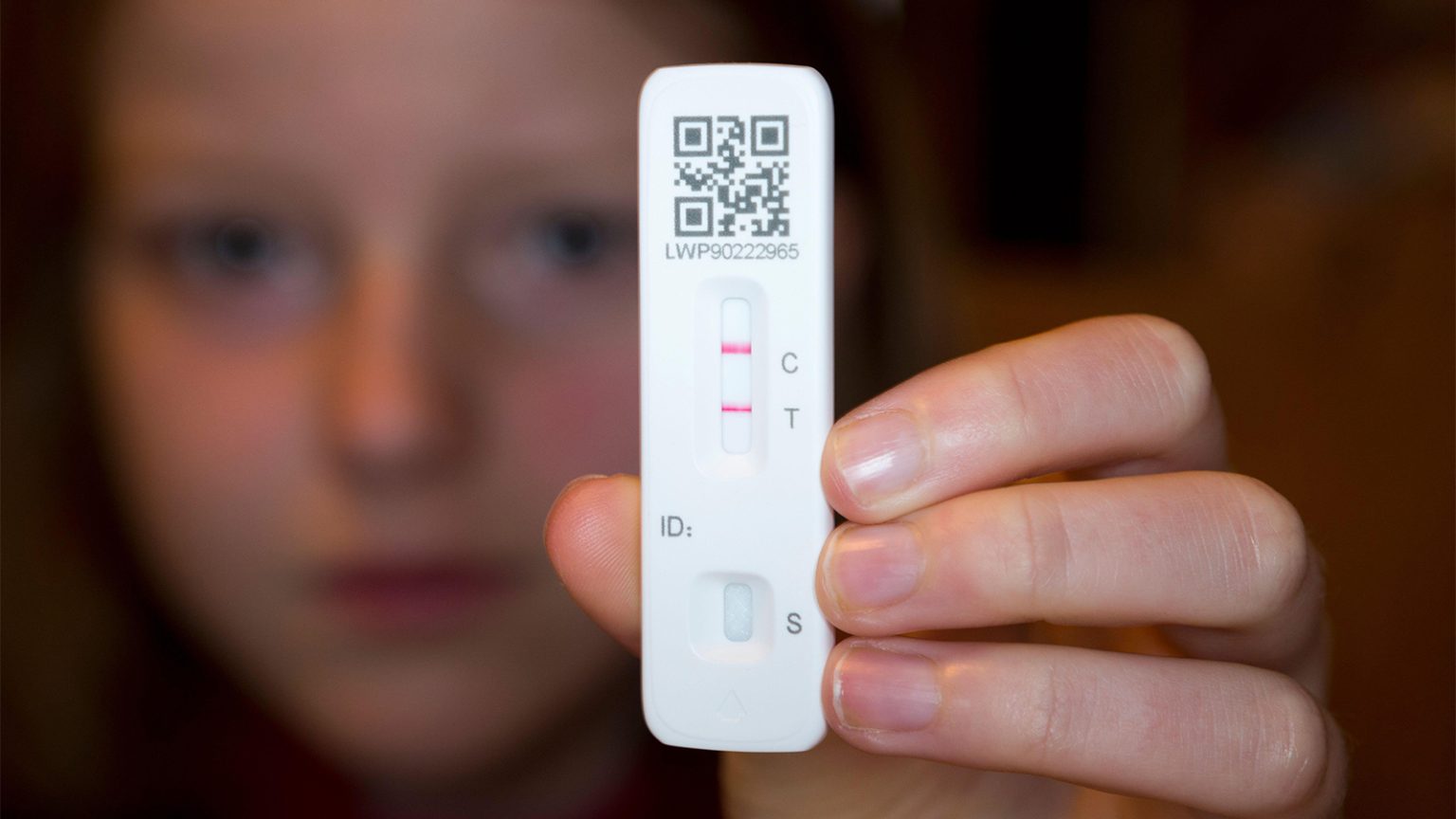 Retrospective Study Links COVID in Kids With Post-Acute Kidney Outcomes