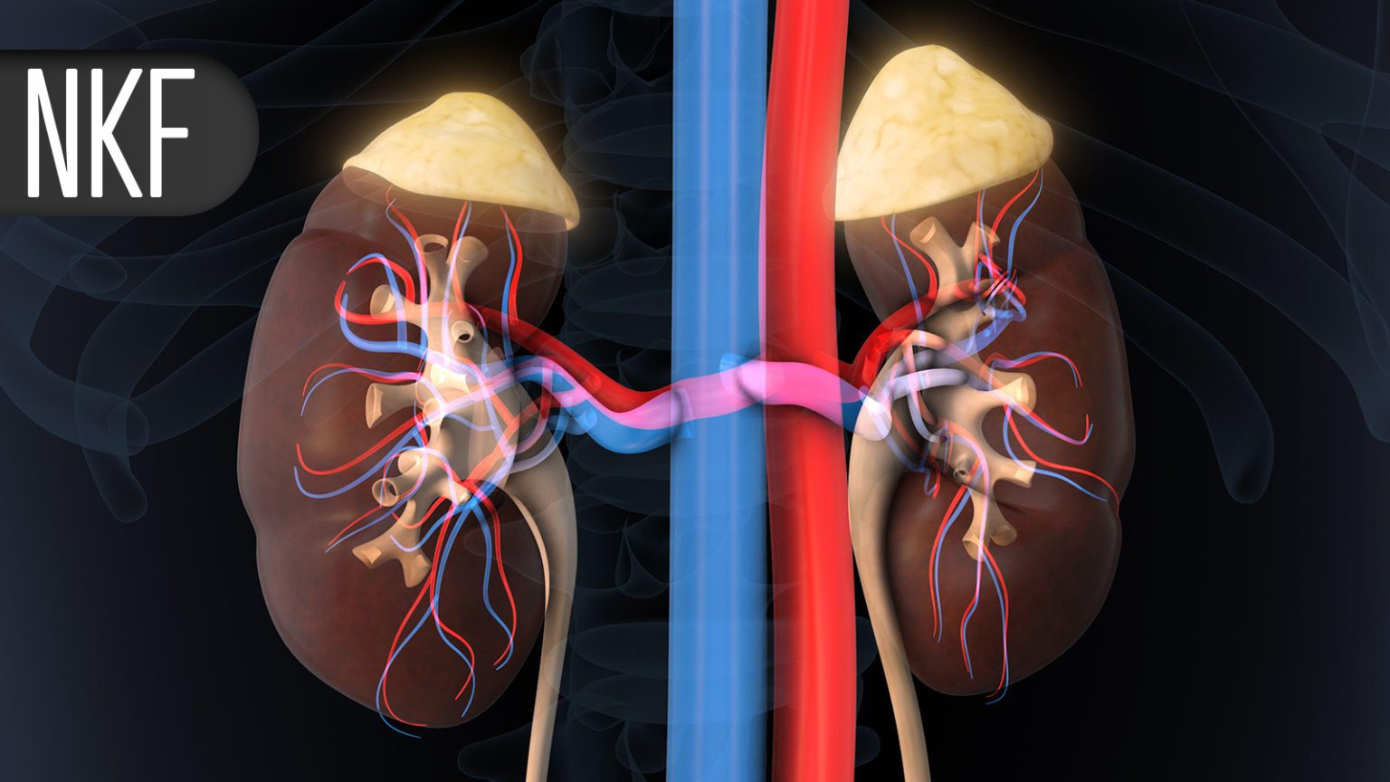 One Diuretic May Be Better for Hypertensive Patients With Kidney Stone History