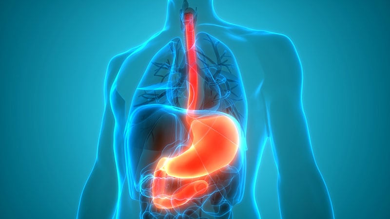 Blood Detection Capsule May Help in Upper GI Bleeding