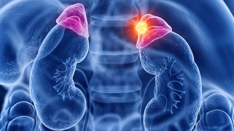 Surgery Treats Hypertension in Patients With Adrenal Tumours