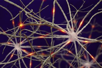 More Americans Have Dementia, Despite Fewer New Cases