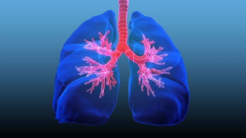 BLVR Requires Revision in 20% of Patients