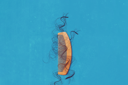 Can You Prevent Hair Loss Before It’s Too Late?