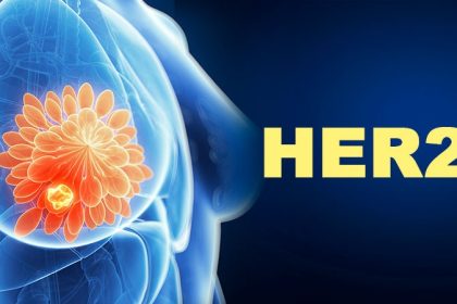 Benefits Persist With Inavolisib in Breast Cancer