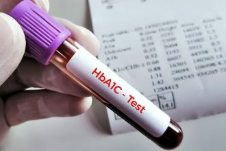 ED Alert Boosts A1c Testing, Not Glycemic Control