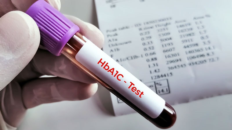 ED Alert Boosts A1c Testing, Not Glycemic Control