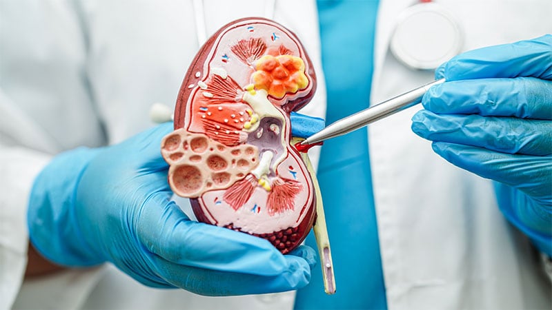Biomarker Trio Shows Promise for Monitoring CKD