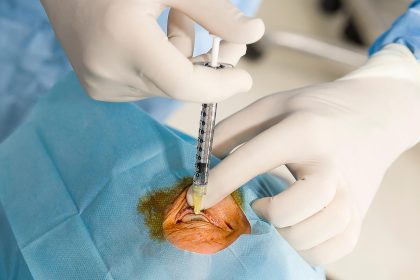 Alternative to Anti-VEGF Shows Safety, Efficacy in Diabetic Macular Edema