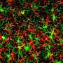 ‘Master control switch’ protein that heightens neurodegenerative disease offers new treatment target