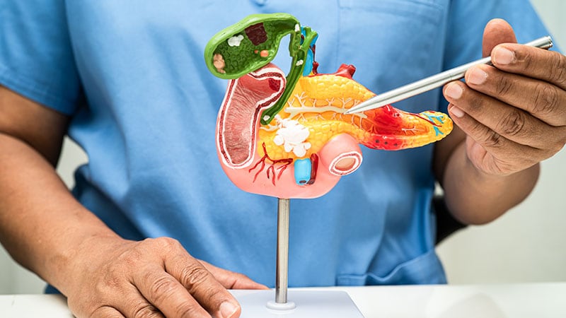 Deep Learning Aids Diagnosis of Chronic Pancreatitis