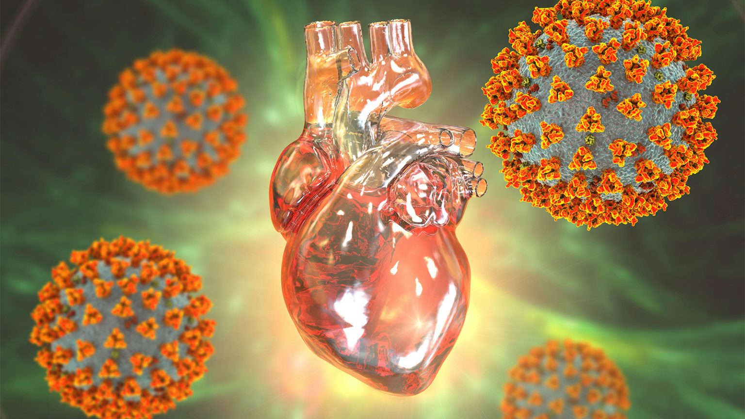 Higher-Than-Usual Number of Cardiovascular Deaths Part of COVID’s Larger Picture