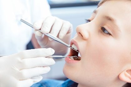 Ending Water Fluoridation Could Lead to Millions of Caries