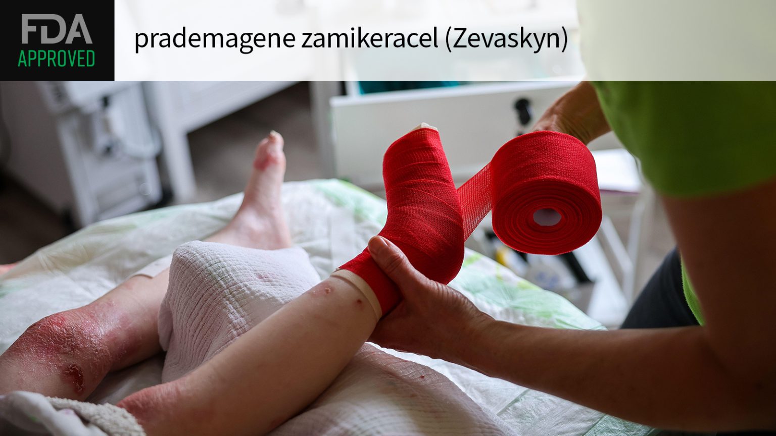 FDA OKs New Gene Therapy for Debilitating Skin Condition