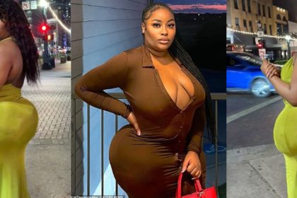 My BBL is TOO Big And Nearly Killed Me – Lady Shares Near-Death Experience After Extreme BBL Surgery