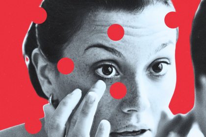 So You Lost Your Contact Lens in Your Eye. Here’s Exactly What to Do