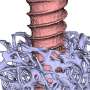 Bone structure model reveals optimal position for screws in fractures