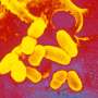 Recent diphtheria epidemic in Western Europe traced to migration routes, not countries of origin