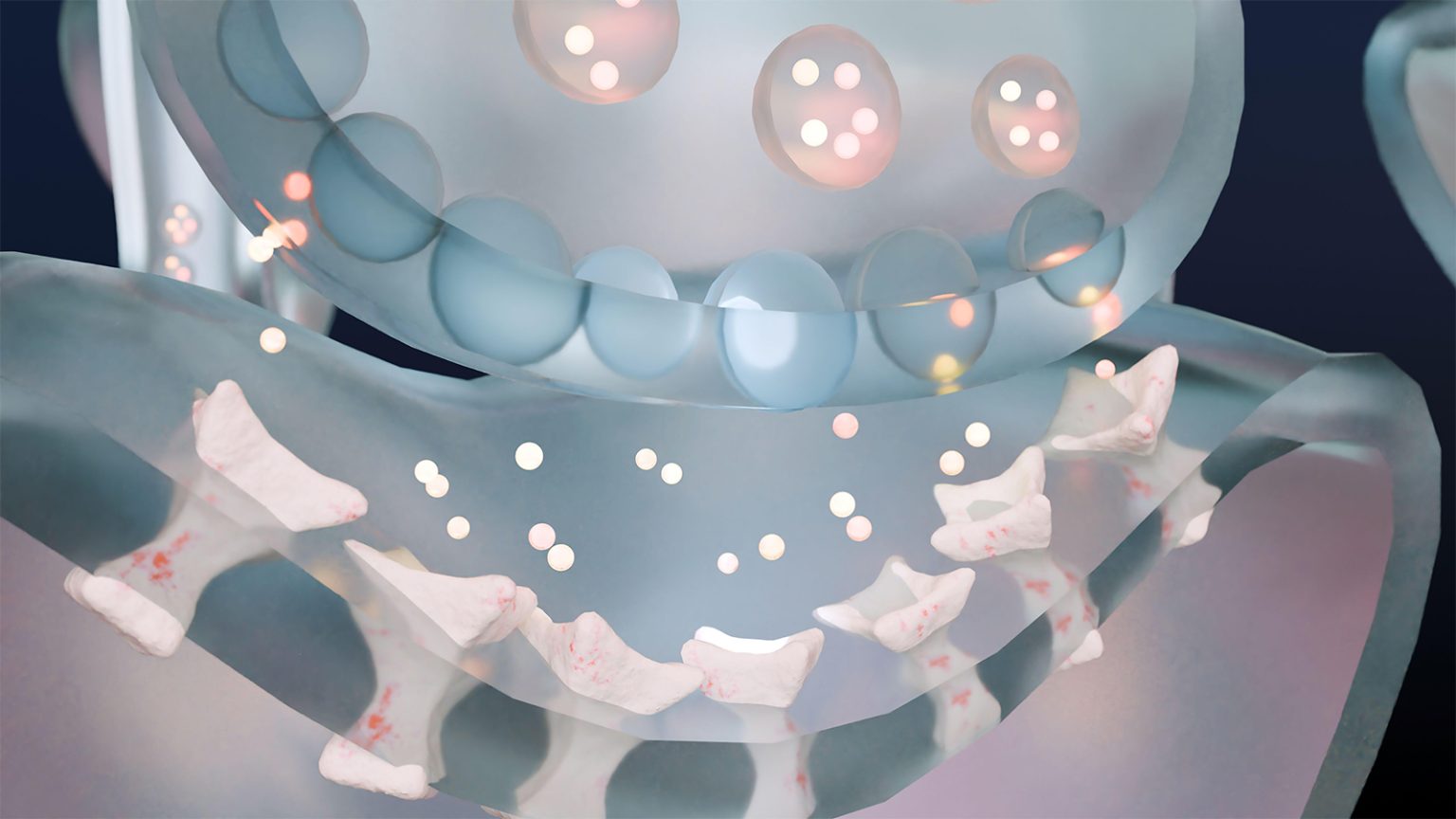 Disparities in Myasthenia Gravis Care