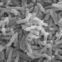 Ivory Coast announces cholera outbreak after 7 deaths
