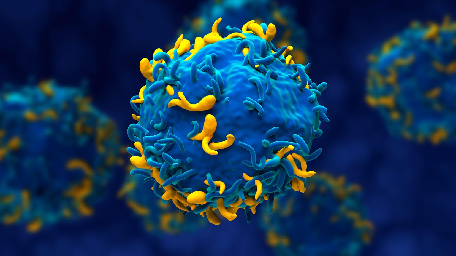 It Had to Happen: CAR T-Cell Therapy for Autoimmune Disease Comes With Side Effects