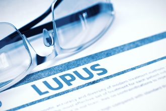 ACR Releases New Guideline for Lupus Treatment