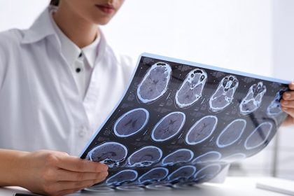 Experimental MS Drug Nearly Eliminates Disease Activity