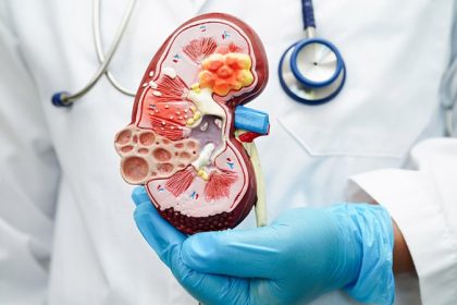 Pegcetacoplan Maintains Kidney Benefits at 52 Weeks