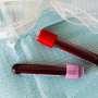 Significant gaps in testing for genetic cancer risk, study finds