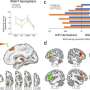 Atypical left-handers use right brain hemisphere for language and left for inhibition, study finds