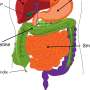 Study: Appendix cancer incidence has quadrupled in older Millennials