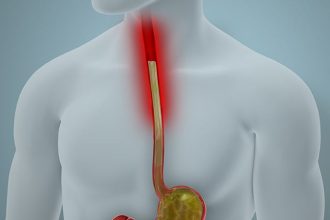 Less Invasive Screening May Identify Barrett’s Earlier