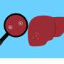Researchers call for urgent study of fungal toxins in Ghana’s liver cancer rise