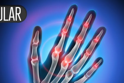 Rheumatology Indication Looks Promising for Efgartigimod