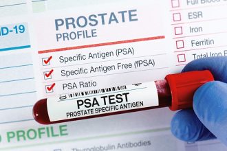 IRONMAN: Can PSA Guide Metastatic Prostate Cancer Care?